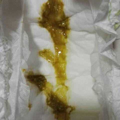 宝宝拉肚子(一直喝奶粉),求解?