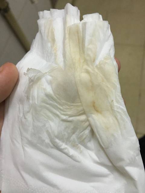 这是要生了吗,有图,慎进_如图,我也不知道是不