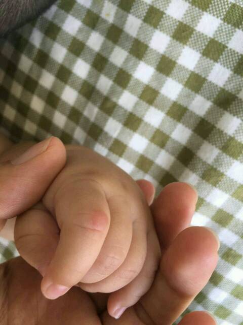 儿子四个月,手指上一个小红疙瘩_儿子四个月,