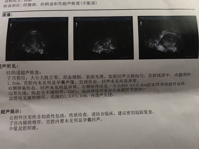 孕6周未见孕囊,出血,右侧附件包块_去医院检查