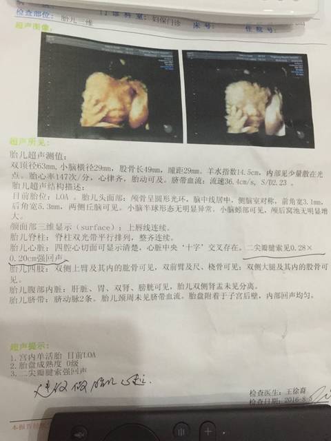 桐乡第一人民医院可不可以做胎儿心脏彩超_桐