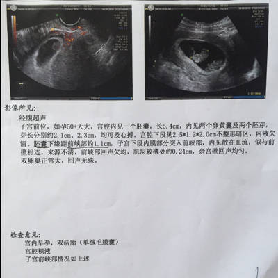 怀孕9周 B超单如下。其中一个胎囊离刀切口1.1Cm 请问小孩能顺利生产吗。_育儿问答_宝宝树