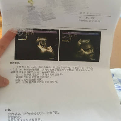 怀孕九周做b超胎盘存活,但是孕囊旁边见2.7cm