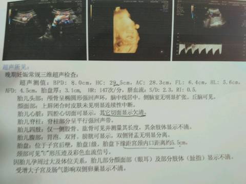 32周彩超盛京没预约上大家都去哪里做的_如题