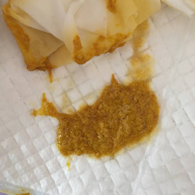 天便5-6次左右,摸肚子总有咕噜噜的屁很多,拉屎