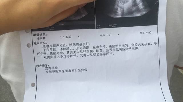 47天去BC医生说多数是胎停育,这是已经留不住了吗?_今天去_宝宝树