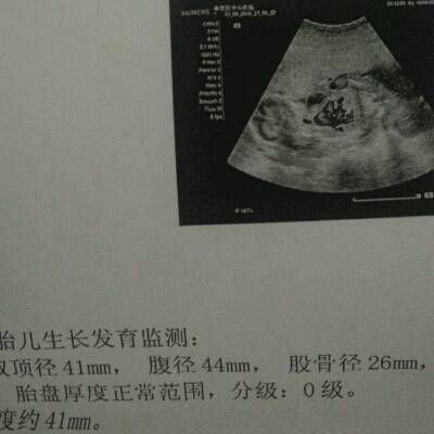 怀孕18周为什么做b超看不见胎儿的形状