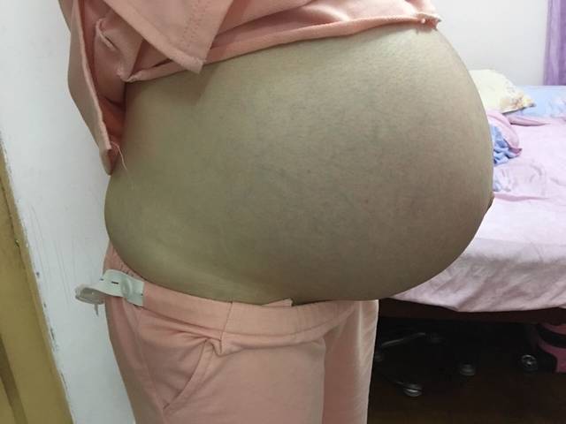孕晚期_肚子越来越大得腰酸背痛