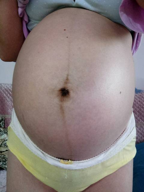 谁会看肚子加B超,猜男宝女宝啊?附图附症状_