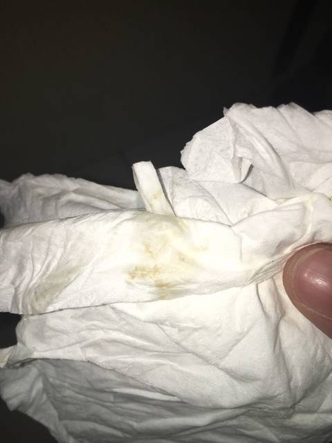 这是出血了吗?急求_怀孕40多天前几天有先兆