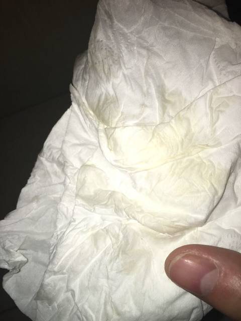 这是出血了吗?急求_怀孕40多天前几天有先兆