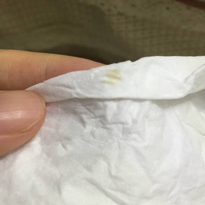 怀孕四个月,最近乳头旁长了好多疹子,怎么回事呀?