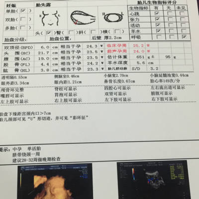 怎么在四维彩超上看男女性别