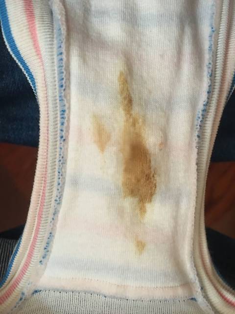 怀孕褐色分泌物_怀孕50多天 内裤上又有褐色分