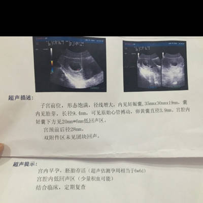 七周,今天去做的彩超。说有少量积血可能,医生