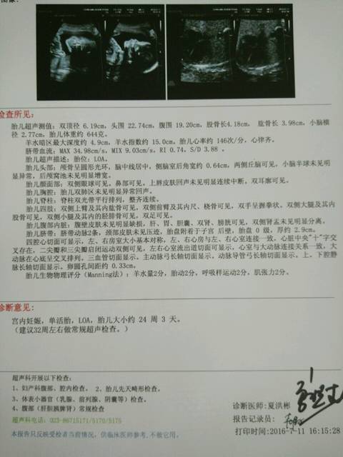 四维彩超通过,还有必要做胎儿心脏彩超吗?_7\/