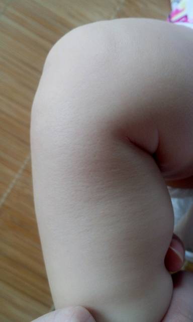宝宝皮肤粗糙_不知道为什么宝宝腿上的皮肤这