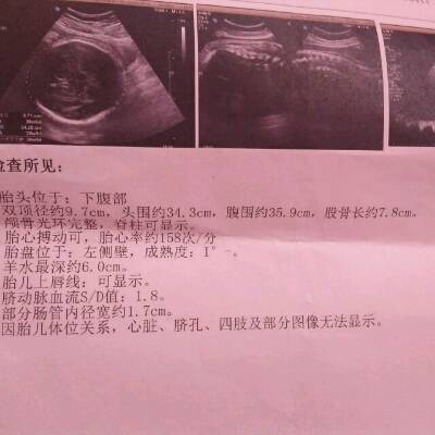 孕38周b超单,看看胎儿发育正常吗?