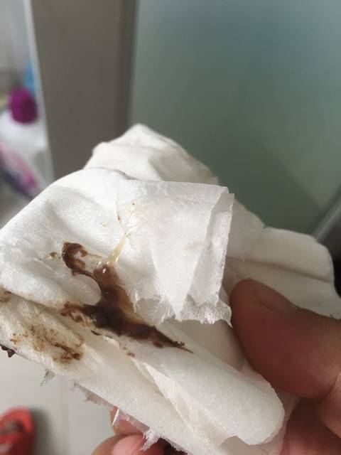 我要疯了!_昨晚去一分院以为羊水破了 医生说