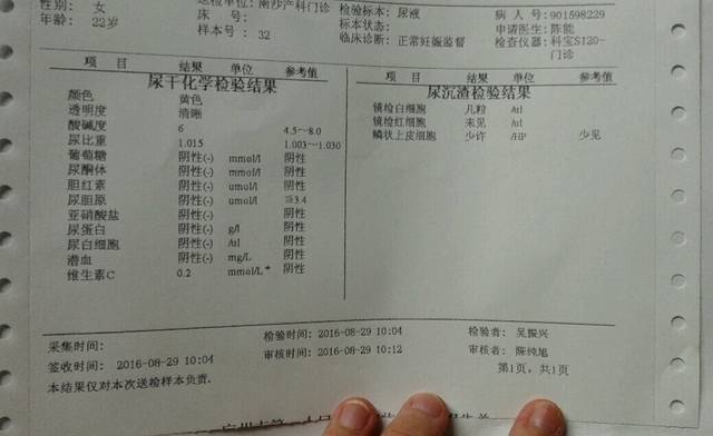 常规,有看得懂的吗?_孕16周去做了唐氏筛查和