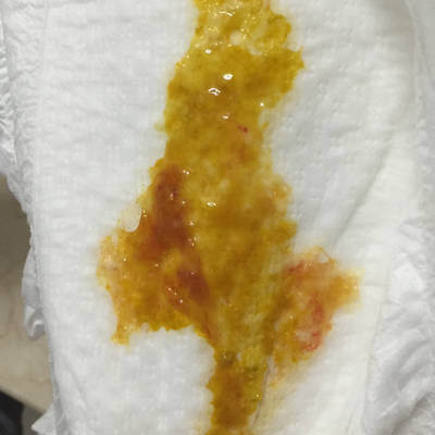 今天宝宝大便次数有点多,刚刚还拉出这个颜色