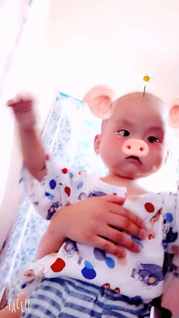 宝宝湿疹身上好干_如题,宝宝都快一岁了,为什