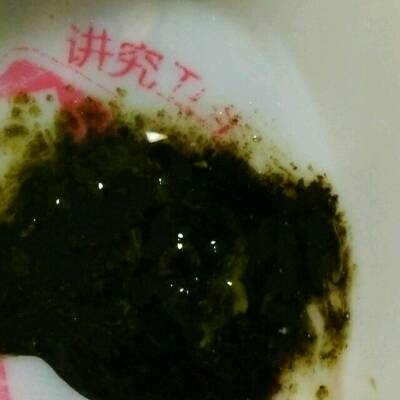 宝妈们,宝宝好几天了拉的都是深绿屎,是怎么回事呀,有图,介意者勿看