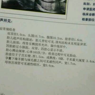 15周的时候检查羊膜和绒毛膜未融合,一直就有褐色的血流出,但是就是