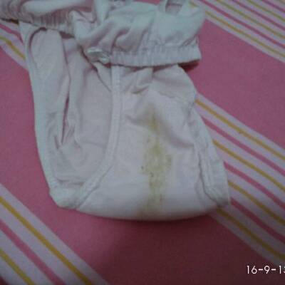 各位宝妈,怀孕早期,阴道分泌物发黄,如下图。有