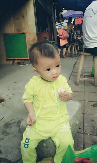 不知道怀孕做了CT和DR,孩子还能要吗?