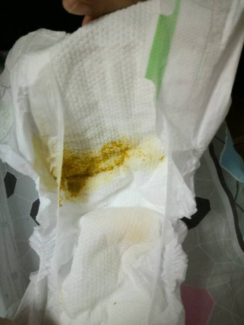 急救!宝宝一吃就拉_宝宝才出生10天,一吃母乳