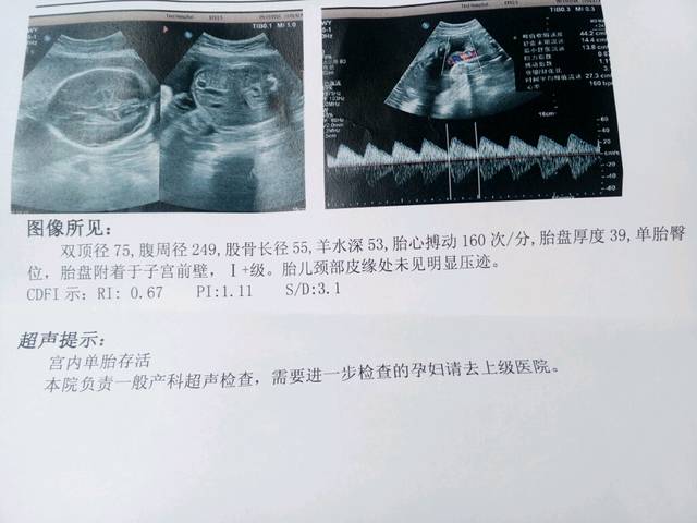 会看B超单的宝妈帮忙看看胎儿大小正常吗?