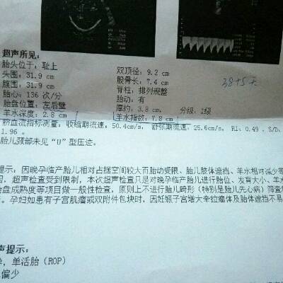 38 5,羊水少,医生让住院引产,无奈