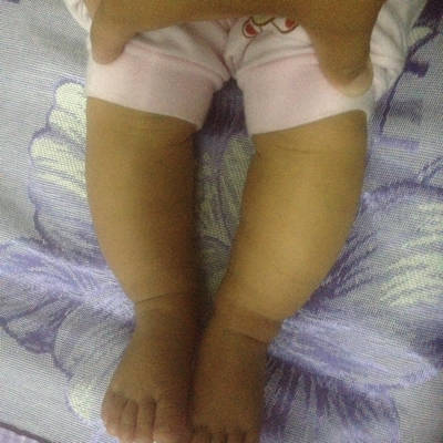六个月的宝宝腿型有影响吗?