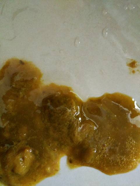 便便有9种颜色,只有3种是健康的(附健康九色卡