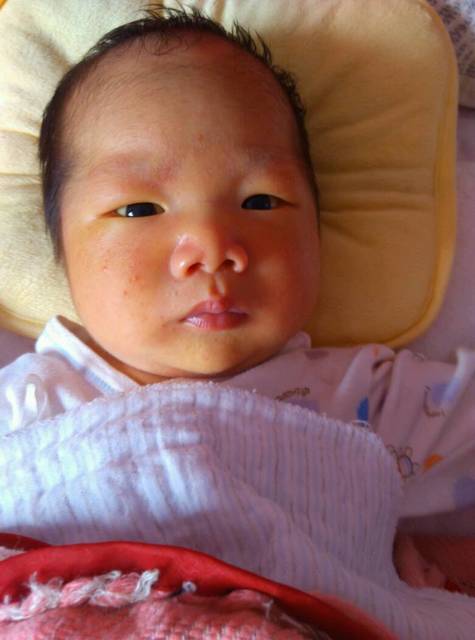 脸上长红点是热疹还是湿疹?_新生儿脸上长红