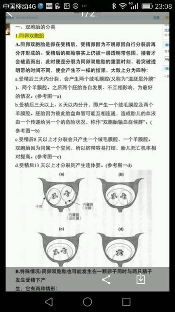 双胞胎妈妈们,同卵双胞胎有两个胎盘的吗?_我