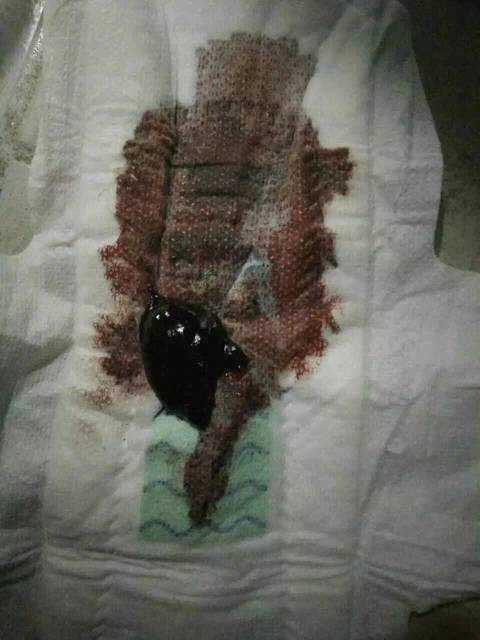 你们会有血块吗?_我用菲纹活磁负离子卫生巾