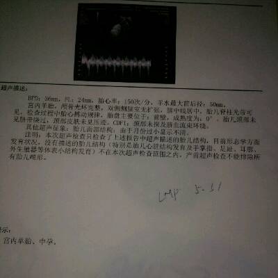 各位帮忙看看这彩超单是头偏大吗,怀孕四个月了