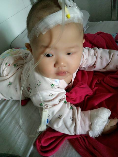 我的六指宝宝手术了_3月15日,我迎来了人生中