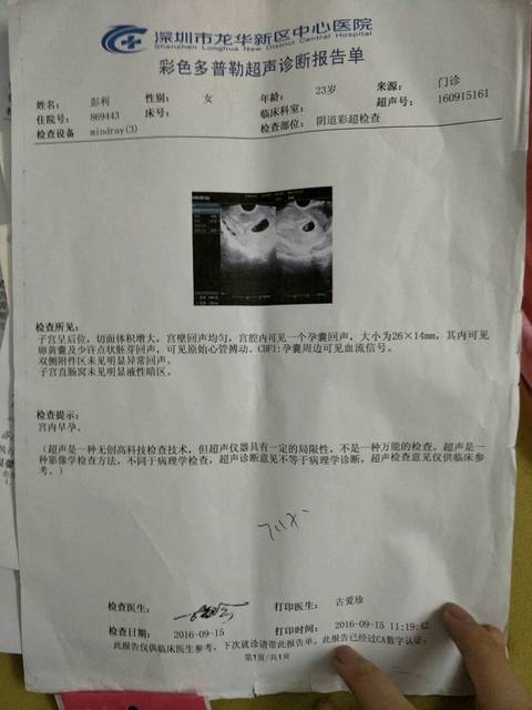 怀孕八周,B超三次