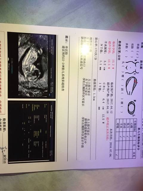 请孕妈帮我看看,今天刚做完NT结果,虽然通过_
