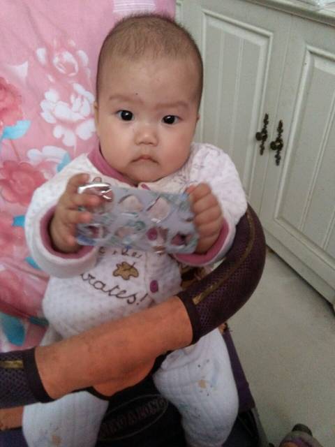 宝宝出生缺氧造成脑损伤_现在宝宝五个月了,各