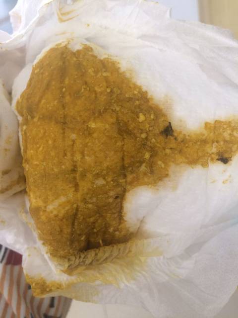 求助求助 两个月婴儿大便有黑色的_早晨还拉的