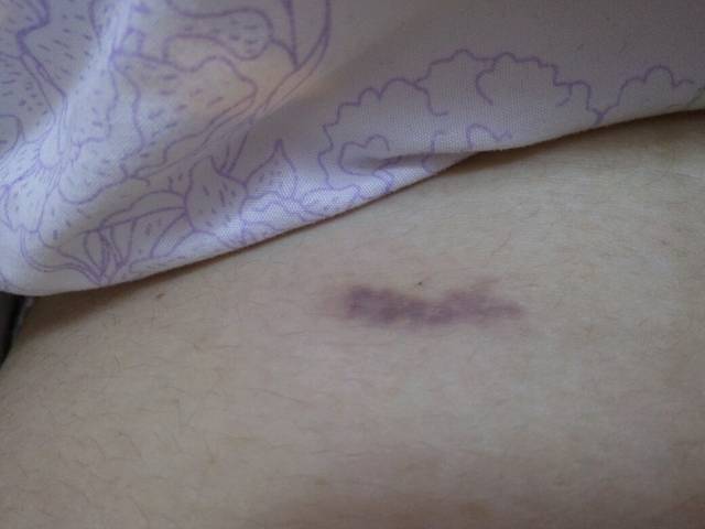 羊水穿刺报告什么时候会通知呢!_9月28号做的