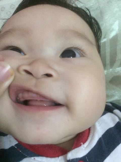 小白粒牙龈上边_宝宝6个月已经有两个乳牙,但
