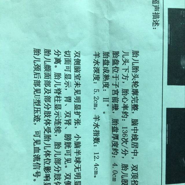 37+2产前大检查胎盘才2级_胎盘才2级,真不知