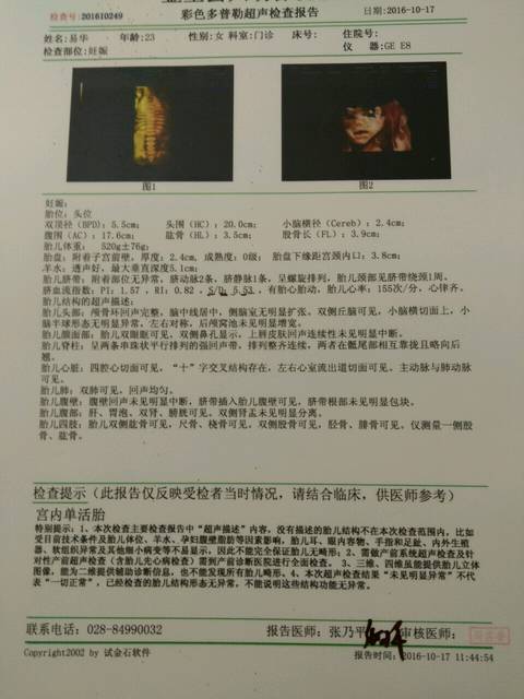 四维彩超_上午做了四维彩超,医生说我的S\/D5