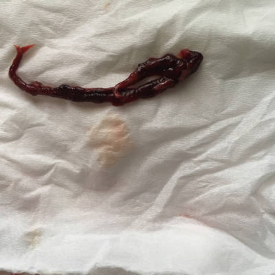 月经平时不规律,前几天测了几天都是隐隐的线