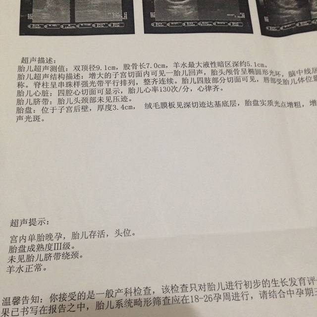 帮忙看看B超单_孕38周多的B超单,按照现在情